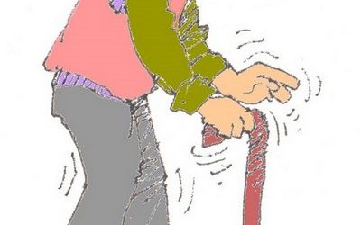 Parkinson’s disease